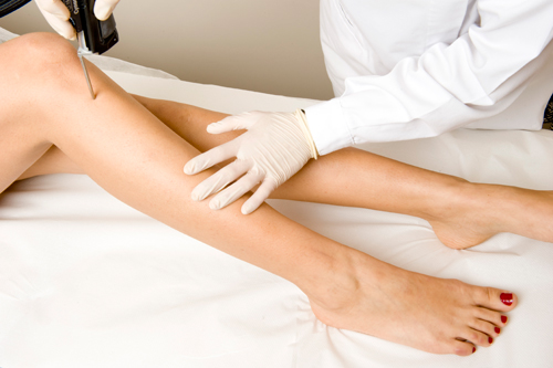 contraindicaciones depilación laser